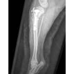 1.1mm ‘T’ Plates - Image 2