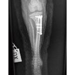 1.1mm ‘T’ Plates - Image 5