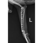 ALPS-3 Titanium Locking System - Image 2
