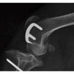Canine Patellar Block - Image 2