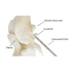 Cannulated Drill Bits - Image 2