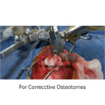 Distraction And Reduction Tool Set - Image 3