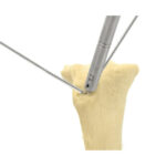 K Wire Bending Iron - Image 2