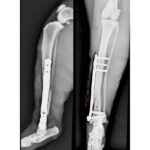 Lengthening Locking Plates - Image 3