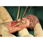 Mini Serrated Bone Holding Forceps - Image 3
