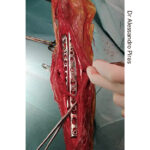 Pancarpal Arthrodesis Locking Plate - Image 3