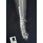 Pancarpal Arthrodesis Locking Plate - Image 4