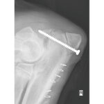 Pointed Reduction Forceps With Aiming Device - Image 5