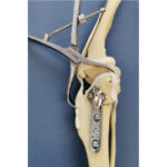 Pointed Redyction Forceps With Spinlock - Image 3