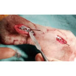 Temporary Reduction-Plate Holding Threaded Pins - Image 2